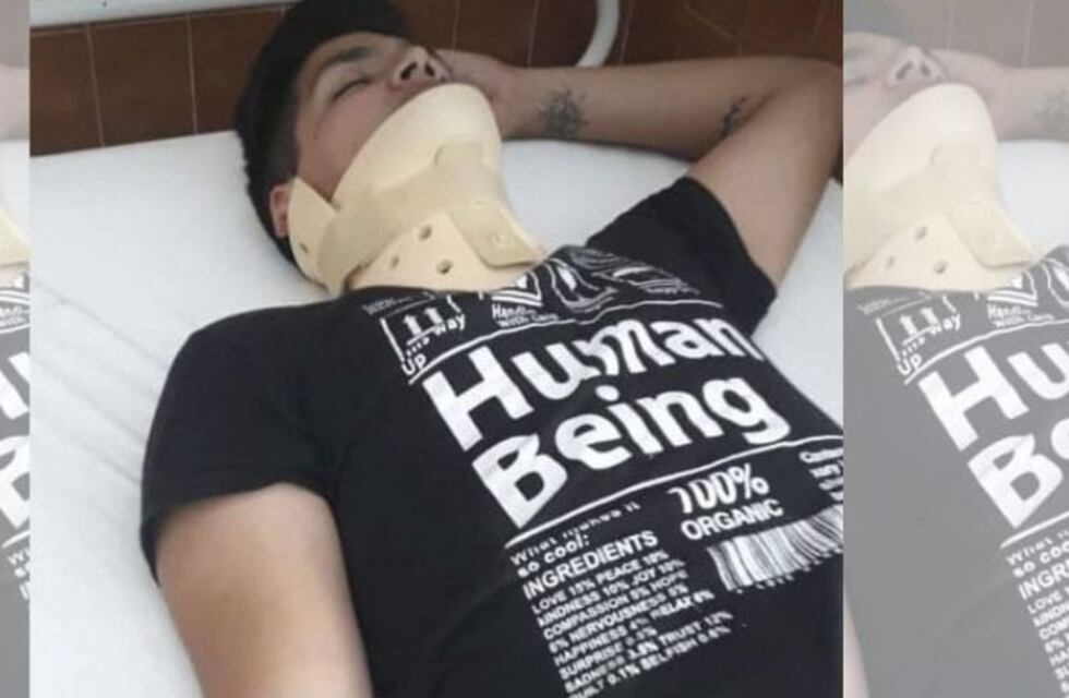 Atacaron salvajemente a un joven de 21 años a la salida de un boliche
