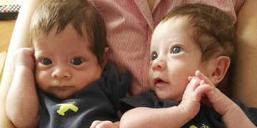 Milo y Jano, los gemelos de siete meses que necesitan un trasplante de médula ósea (Foto: Facebook)