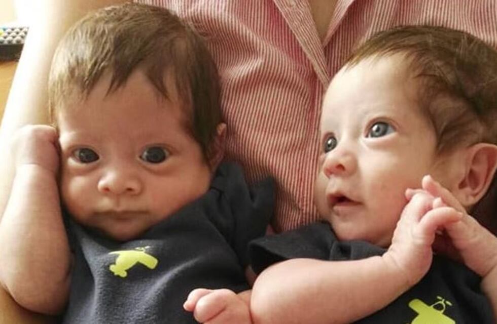 La historia de Milo y Jano, los gemelos de siete meses que necesitan un trasplante de médula ósea