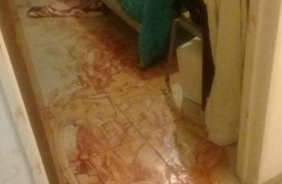 La joven que mutiló a su amante habría dicho: 'No sé qué corté'