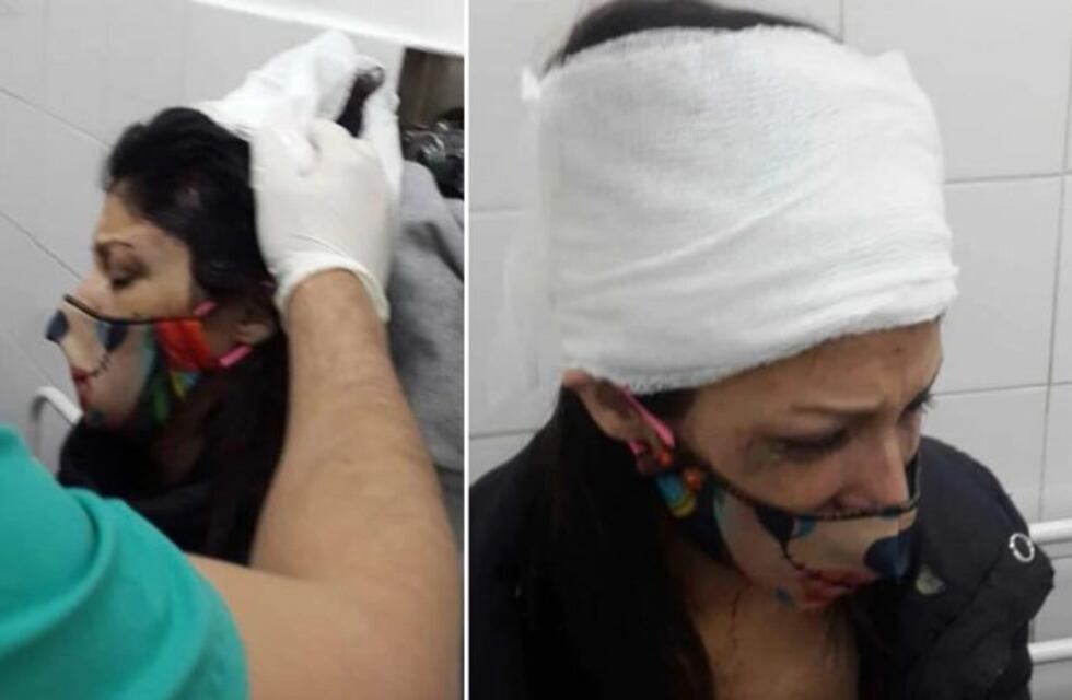 Su expareja la sorprendió, le sacó el botón antipánico y la golpeó hasta dejarla inconsciente