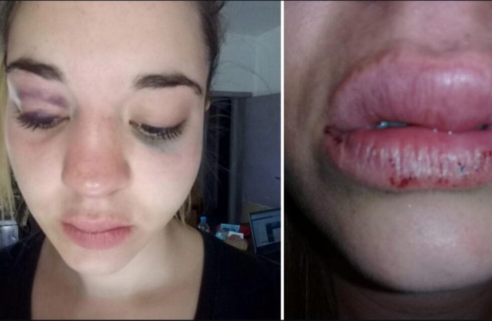 Inseguridad en Azul: golpearon a una chica para robarle el celular