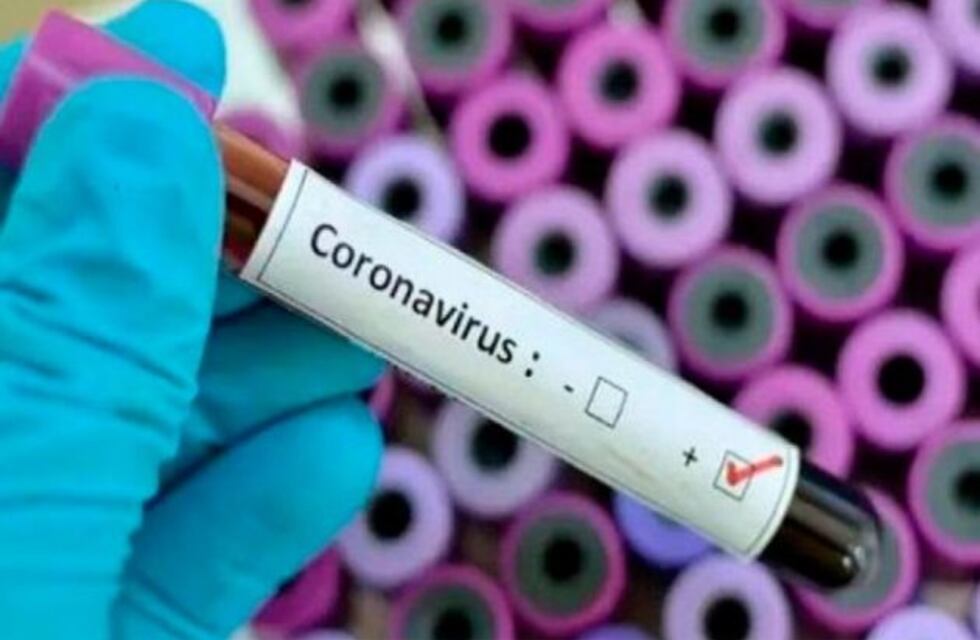 Concordia implementó el Protocolo sobre Coronavirus