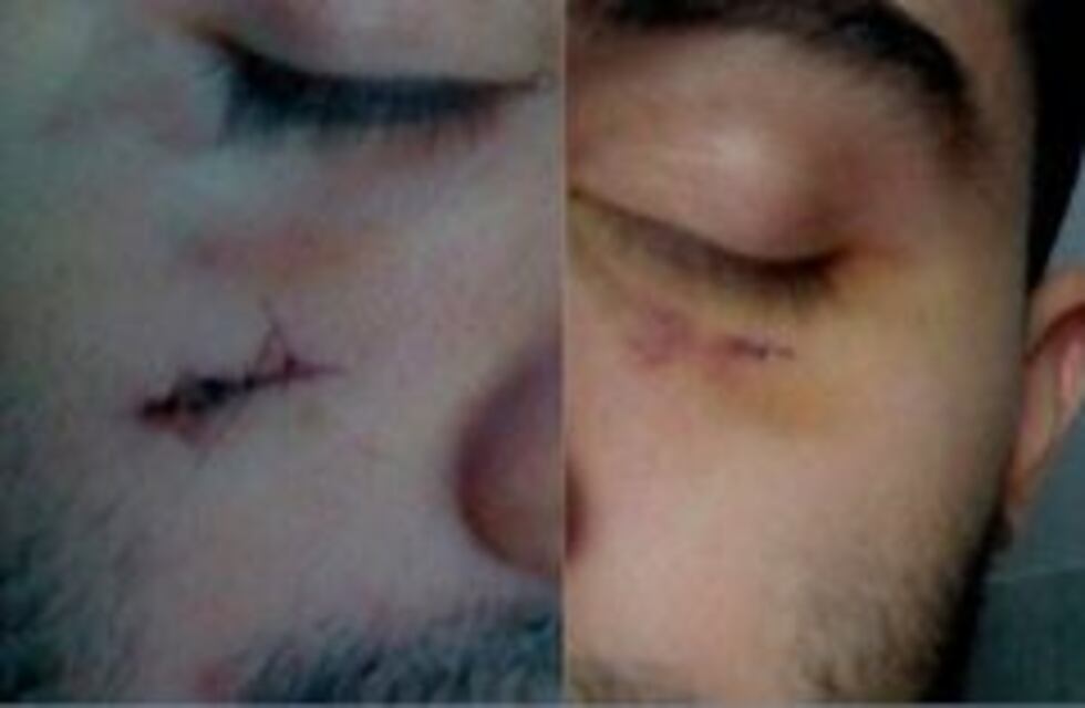 Un grupo de jóvenes fue interceptado por un automovilista que terminó apuñalándolos