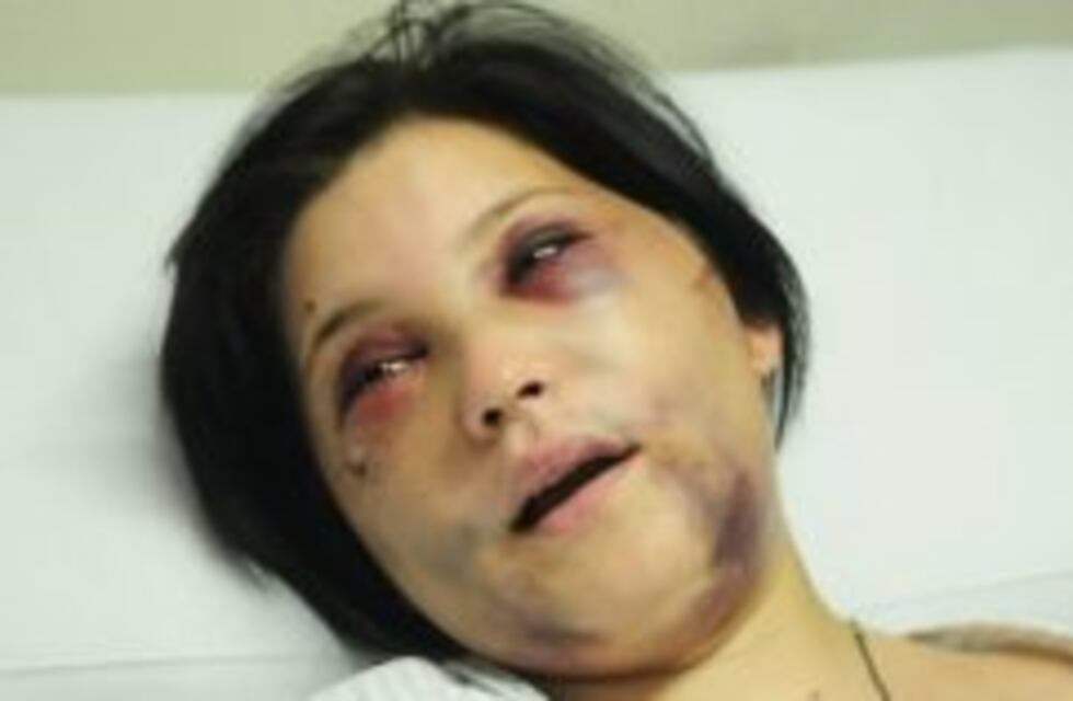 Dieron de alta a la joven golpeada por el anestesista