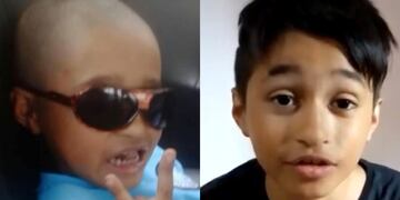 El pequeño fue diagnosticado con un extraño cáncer a los 3 años.