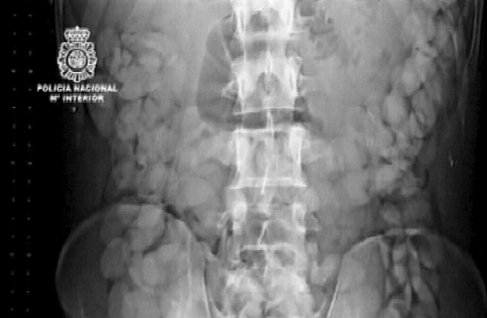 Se tragó 20 cápsulas de cocaína, se descompuso y terminó condenado a 4 años