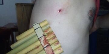 Así quedó lesionado uno de los músico\u002E