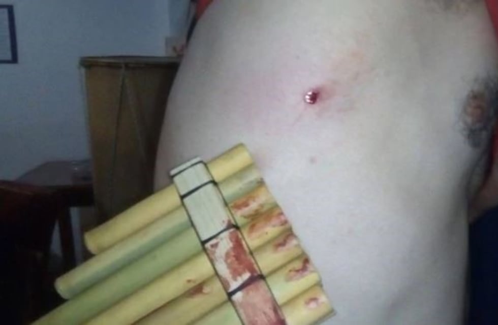 Un grupo de músicos fue atacado con un rifle de aire comprimido en Parque Chacabuco