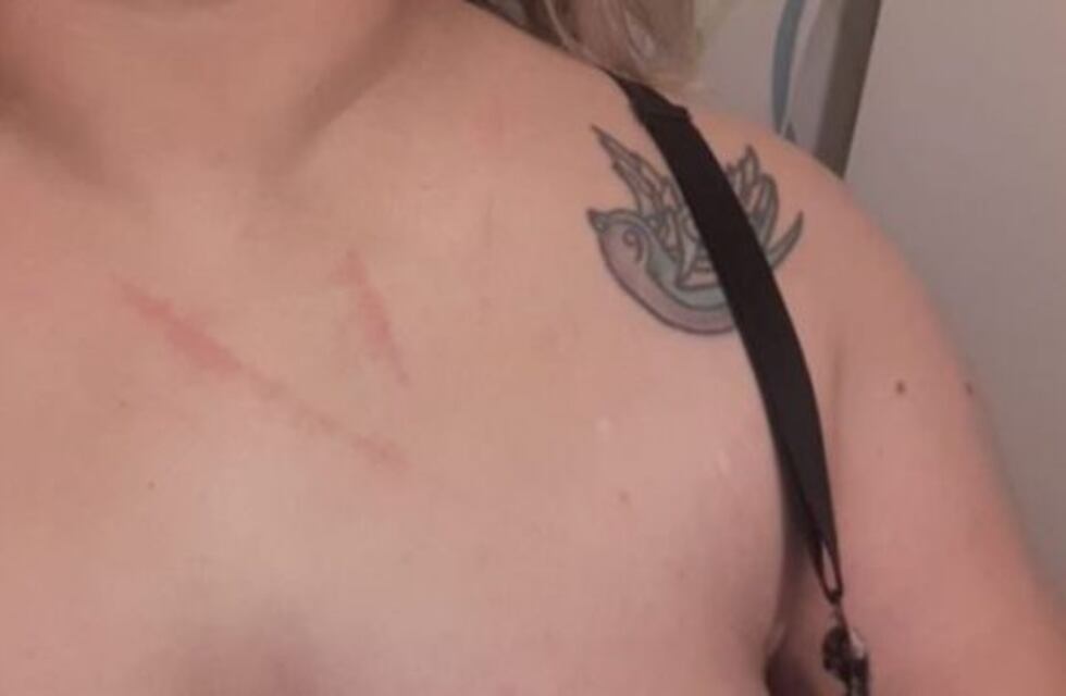 Una periodista de Ushuaia fue atacada brutalmente a cuchillazos