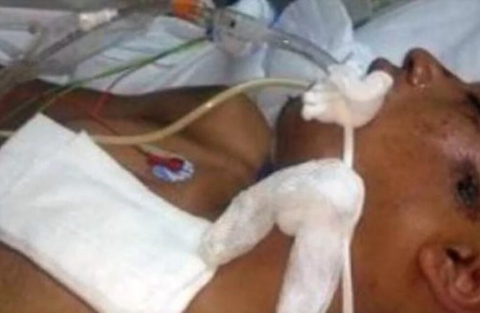 Un joven quedó en coma tras ser perseguido por la Policía por un robo que no cometió