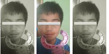 El accidente se produjo en la escuela Teniente Ibáñez\u002E