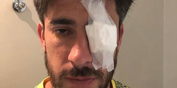 Pablo Pérez fue blanco de las cargadas de Central