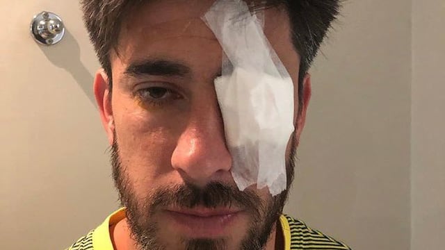 Pablo Pérez fue blanco de las cargadas de Central