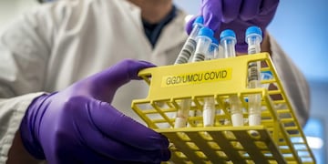 Utrecht (Netherlands), 25/09/2020\u002E- A researcher compares the results of a rapid corona test and a normal corona test during a trial at UMC Utrecht in Utrecht, The Netherlands, 25 September 2020\u002E The rapid test indicates within 15 minutes whether someone has the lung virus\u002E Normally it takes 24 to 48 hours for the results to be known\u002E (Países Bajos; Holanda) EFE/EPA/LEX VAN LIESHOUT