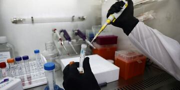 A doctor takes part in a demonstration for Reuters of ongoing clinical trials led by Sheba Medical Center and Israeli firm Newsight Imaging, in which they say a newly developed saliva test aims to determine in less than a second whether or not you are infected with the coronavirus disease (COVID-19), at Tel Hashomer in Ramat Gan, Israel August 13, 2020\u002E REUTERS/Ammar Awad