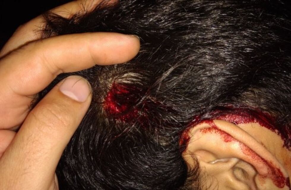 Entre cuatro, secuestraron y golpearon a un remisero para robarle