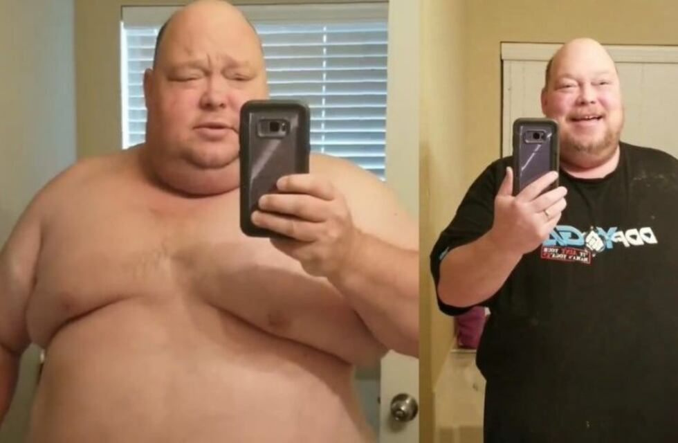 Un hombre logró perder 90 kilos en un año