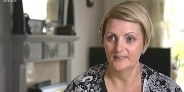 Le amputaron la oreja tras detectarle un melanoma en etapa 3C\u002E