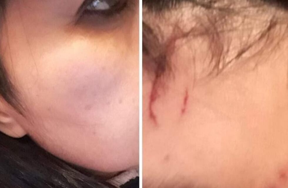 Punta Alta: Una mujer recibió amenazas y luego la golpearon adentro de un Banco