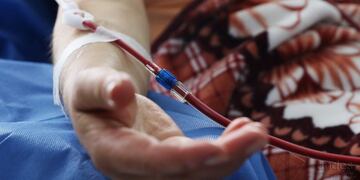 11/10/2017 Diálisis SALUD ESPAÑA EUROPA FLICKR/ANDES