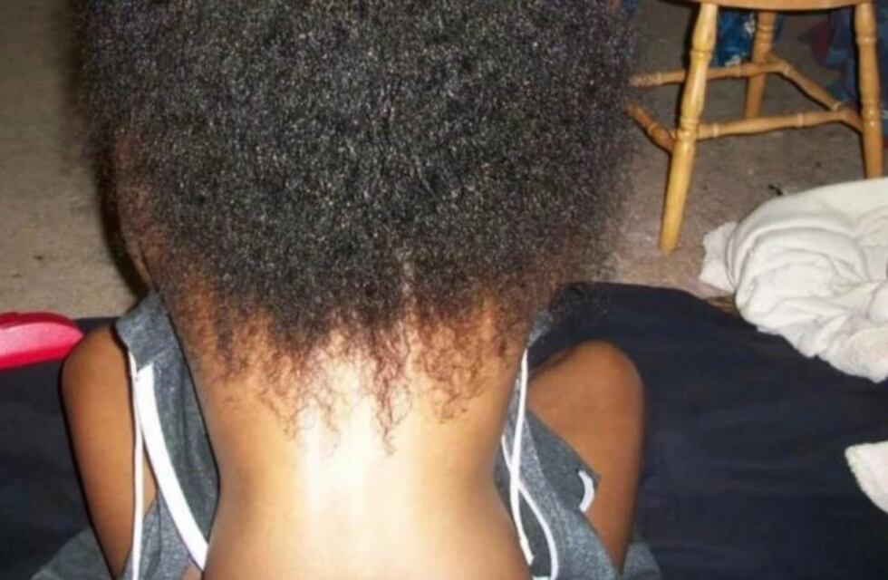 La imagen viral que confunde a todos: ¿es un cuello o una espalda?