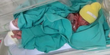 Nacieron trigemelas idénticas en Lomas de Zamora (Foto: Clarín)