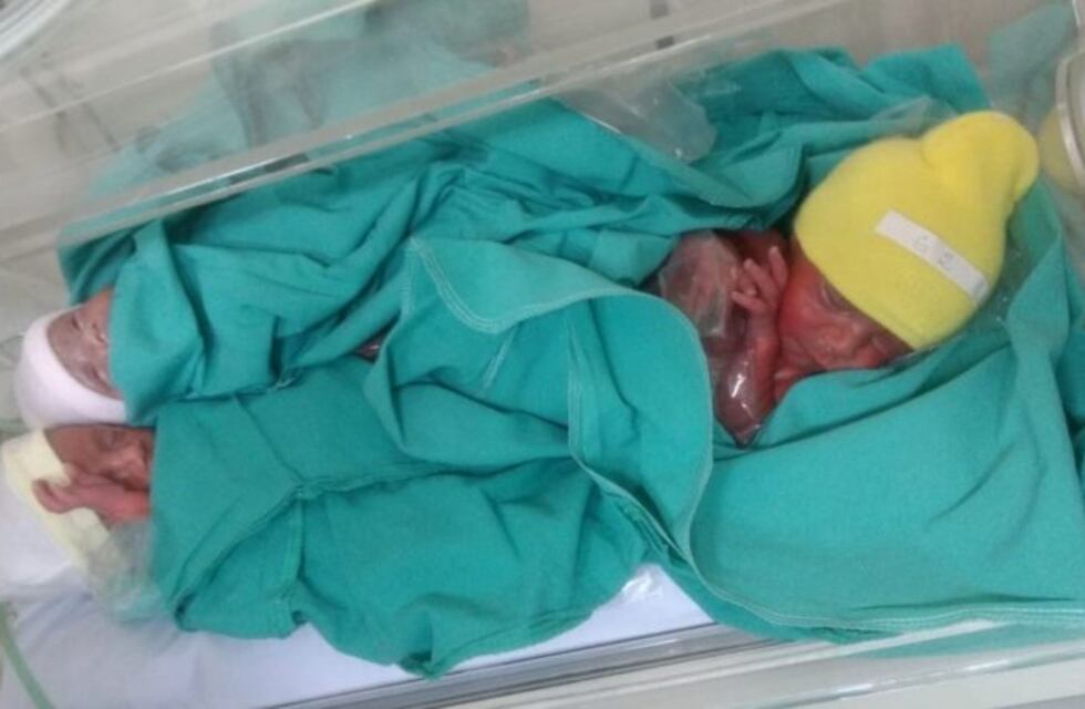 Nacieron trigemelas idénticas en Lomas de Zamora