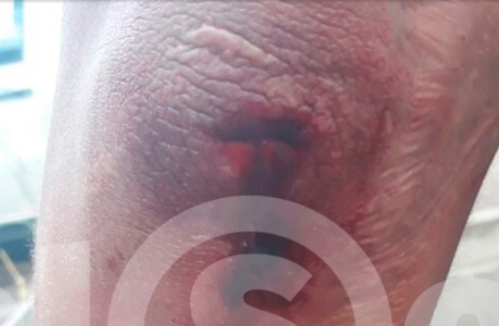 Godoy Cruz: hirieron a un policía de un machetazo