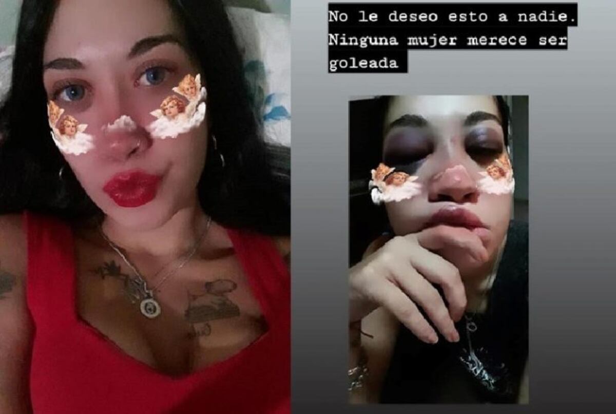 Melisa Rivera golpeada por su ex pareja