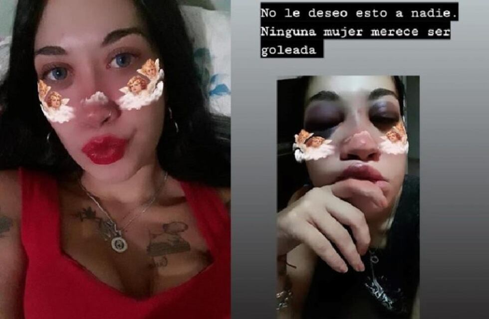 Se metió en la casa mientras su ex pareja dormía y le dio una paliza