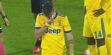 Paulo Dybala deja el campo de juego al lesionarse en el partido frente al Cagliari\u002E