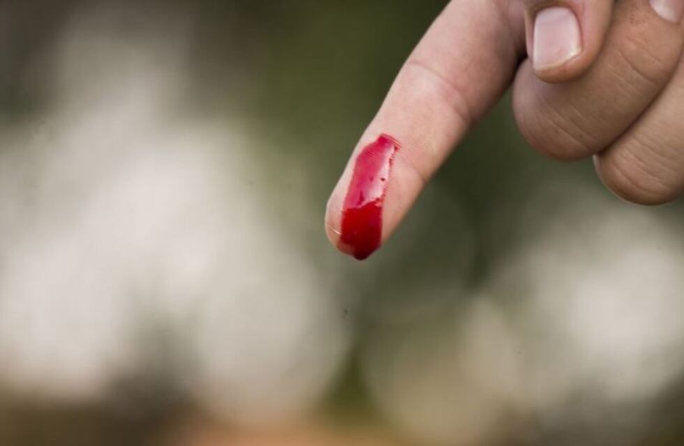 Las heridas se curan más lento si ocurren de noche