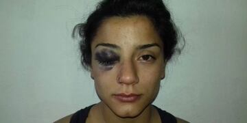 Gentileza: Imneuquén\u002E