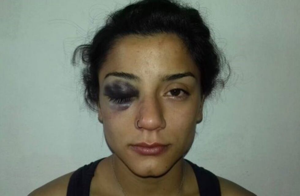 Una pareja denunció que fue golpeada por policías en Plottier
