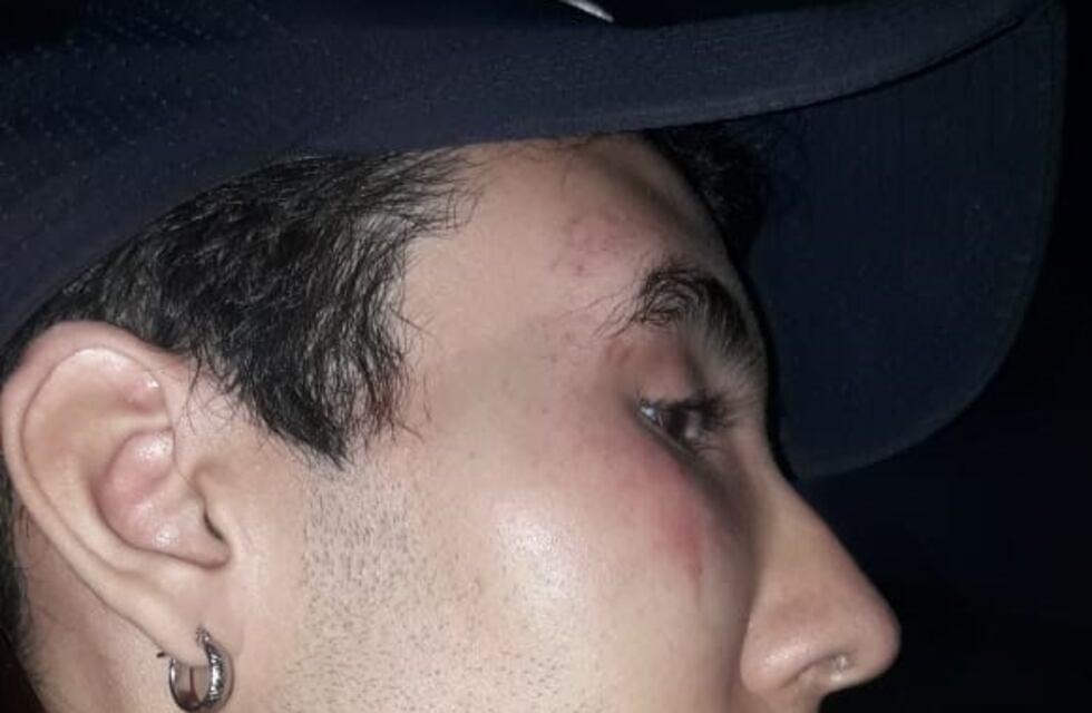 El adolescente detenido y golpeado "por zurdo" dijo que también le robaron