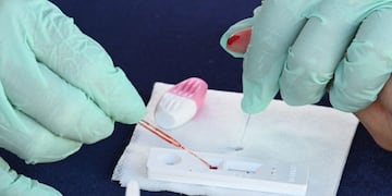 test rapido anticuerpos serologico