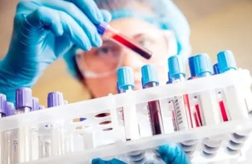 Mendoza sumó un nuevo caso positivo de coronavirus