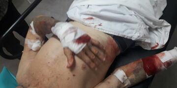 Tras el robo, el anciano quedó tendido en el piso de su vivienda, donde fue socorrido por una vecina\u002E (Radio Eme)