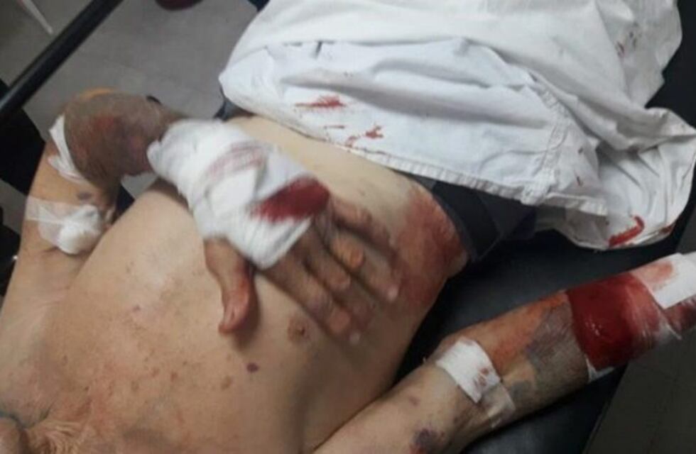 Golpearon brutalmente a un jubilado para robarle 250 pesos