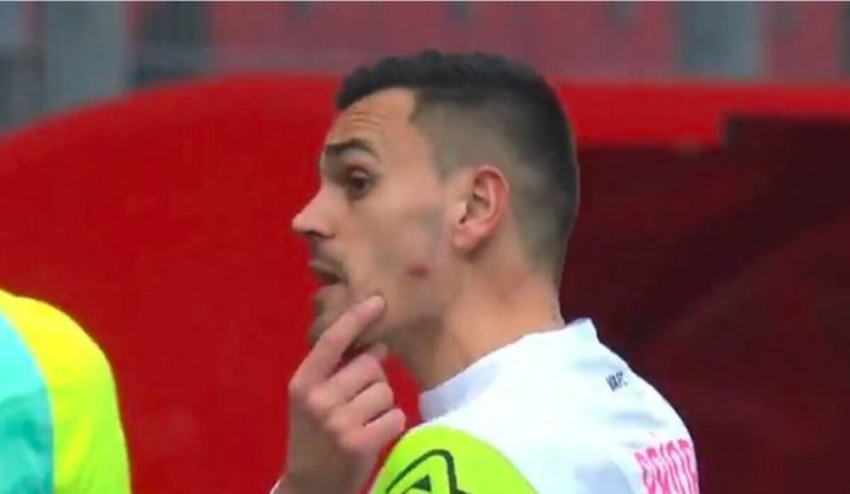 Escándalo en Francia: un futbolista mordió al arquero rival en la cara\u002E (Captura)