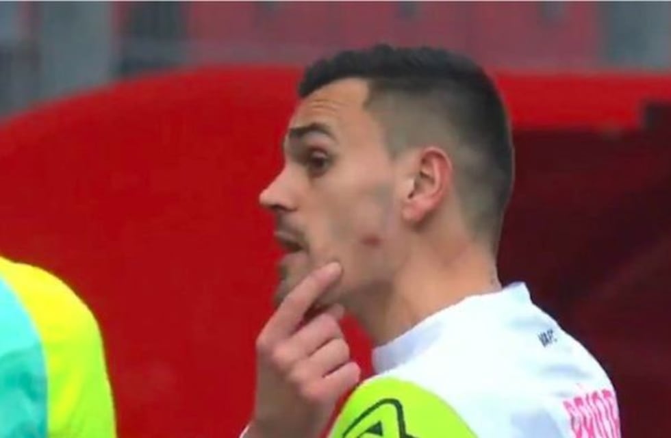 Escándalo en Francia: un futbolista mordió al arquero rival en la cara