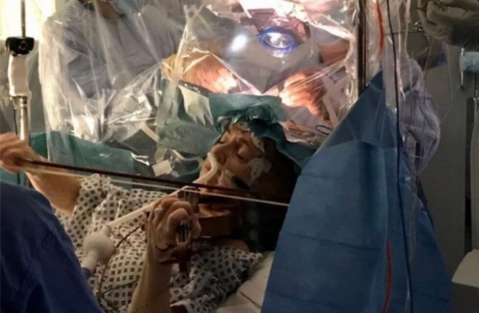 Esta mujer tocó el violín mientras le hacían una cirugía en el cerebro