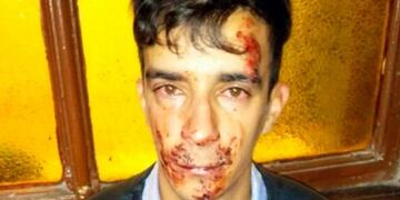 Ataque a electricista de la plata