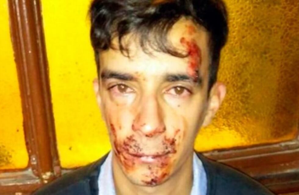 Brutal ataque de una patota de adolescentes a un electricista en La Plata