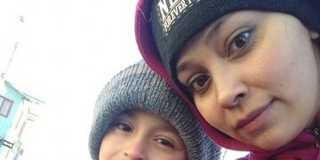 Axel padece de Queratocono, una afección ocular progresiva y necesita de la ayuda de todos\u002E