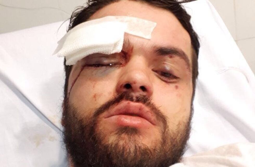 Brutal ataque homofóbico en Palermo: lo golpearon en patota por ser gay