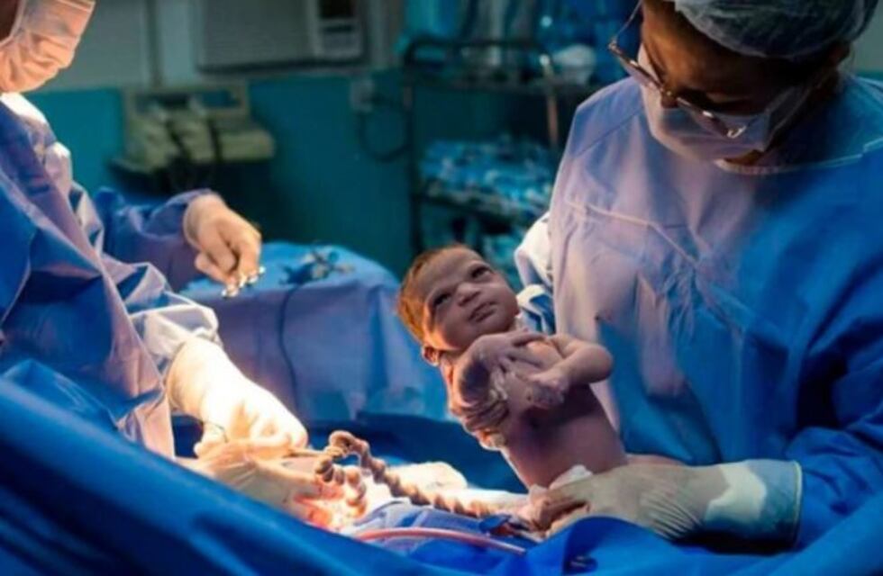 La foto de una "bebé enojada" que se hizo viral a pocos segundos de haber nacido