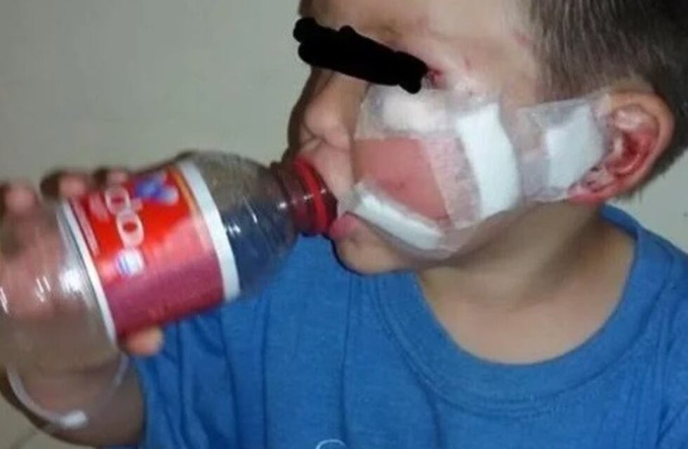 Un nene entró a buscar la pelota a la casa del vecino y un perro le destrozó la cara