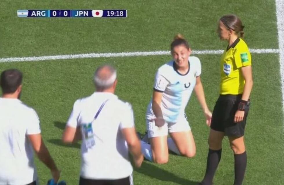 Mundial Francia 2019: Aldana Cometti perdió un diente por un codazo de una japonesa